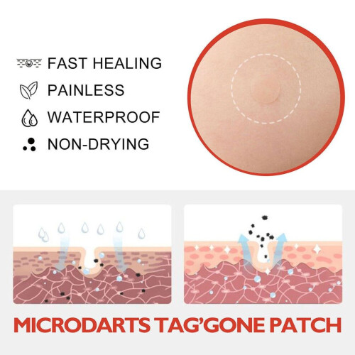 Blusoms Microdarts Tag'gone Patch, neutroera Blusoms Pro Microdarts Taggone Patch 1