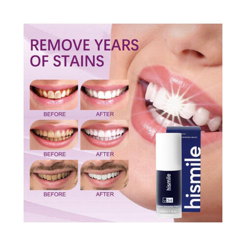 (Hismile B 30ml) Οδοντόκρεμα λεύκανσης δοντιών Hismile Οδοντόκρε 2