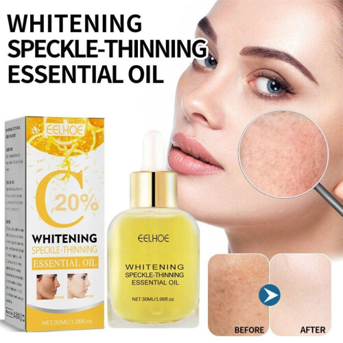 Esencia facial aclarante para manchas blancas de Eelhoe 2