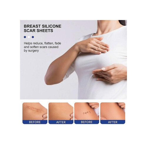 Silikon ärrdukar Silikon ärrdukar för bröst 8-pack Bröstförminskning efter operation för ärr, 2