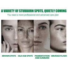 EELHOE Dark Spot Correcting Glow Serum, Beauty Skin Stains Freckles Melanin Repair Dark Skin Care