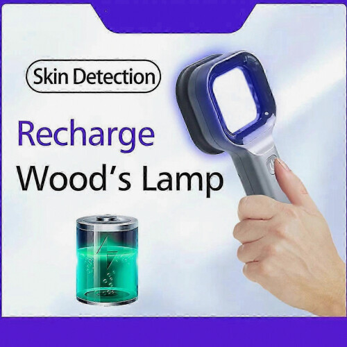 Woods Lamp Skin Analyzer Φορητός του προσώπου Σαλονιών Ομορφιάς Λαμπτήρας Woods Αναλυ 1