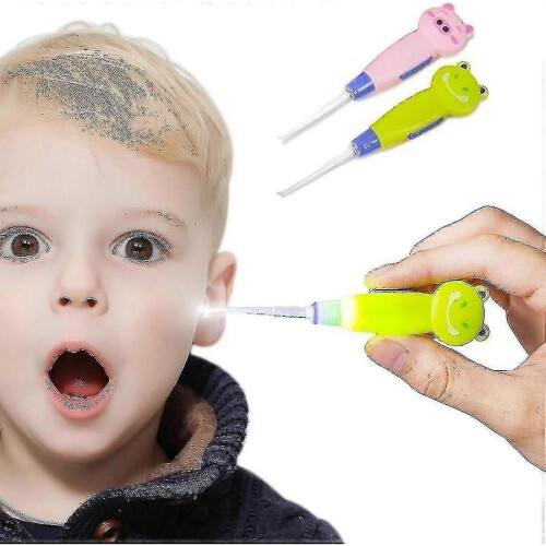 Ear Wax Removal Tool for Kids with Led Light, Remove Ear Wax with Led Light for Easy Access 2pack
