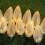 Premier Set of 20 Pine Cone Christmas String Lights with 80 Warm White LEDs 3