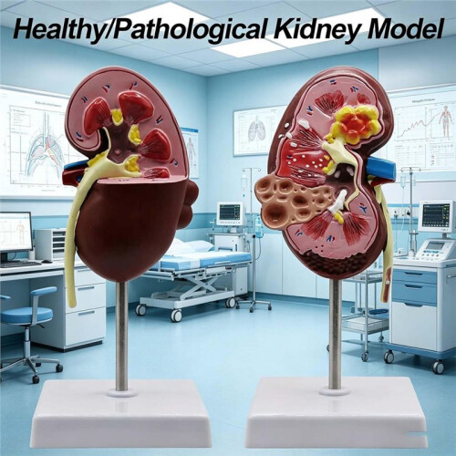 Anatomical Human Kidney Model with Pathologies - Realistic Teaching Aid for Nephrology & Urology Studies 1