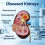 Anatomical Human Kidney Model with Pathologies - Realistic Teaching Aid for Nephrology & Urology Studies 3
